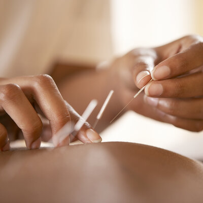 365 Akupunktur-Punkte unterstützen deine Gesundheit