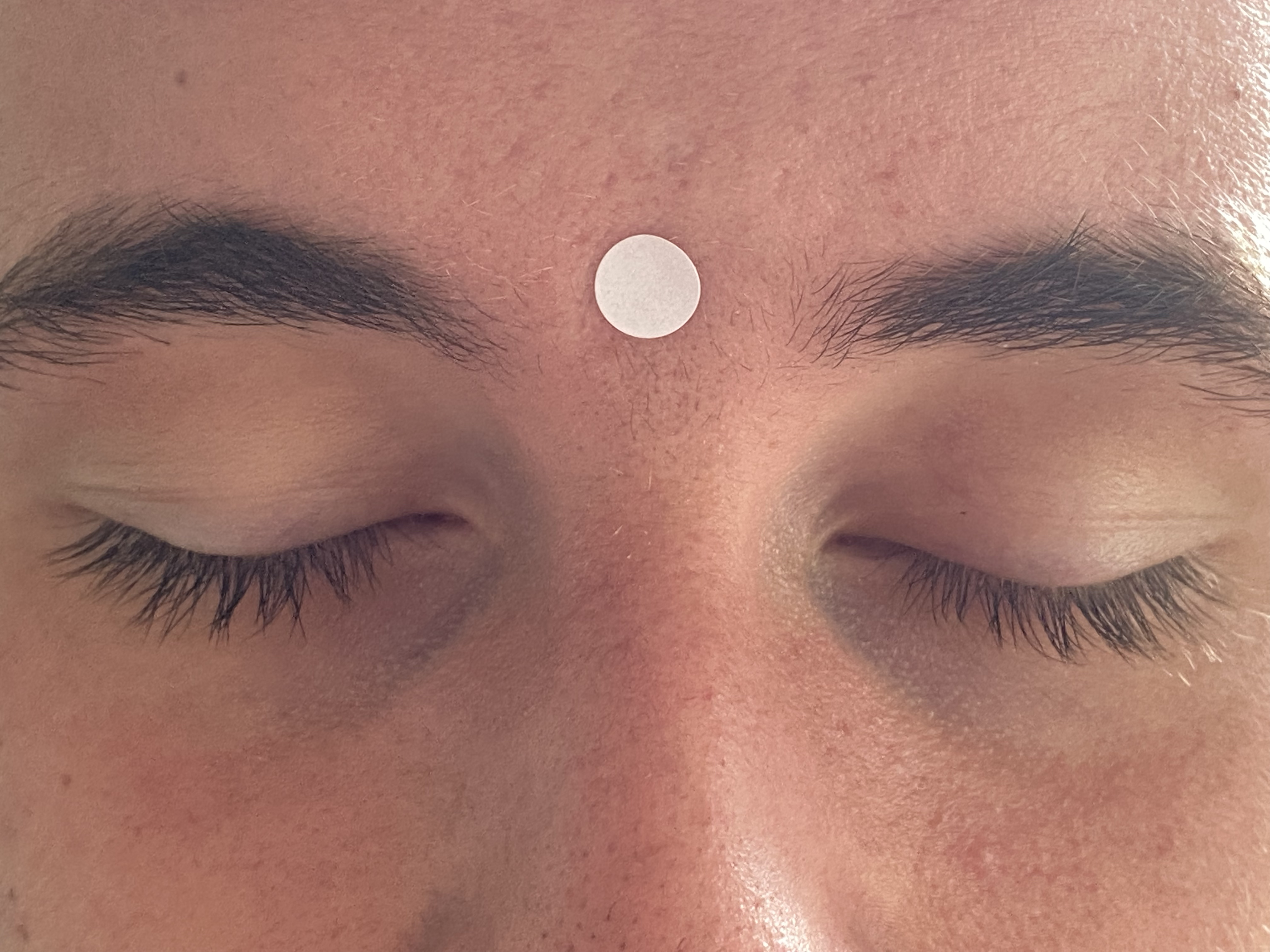 Rescue Punkte, Akupressur als Selbsthilfe bei Schmerzen